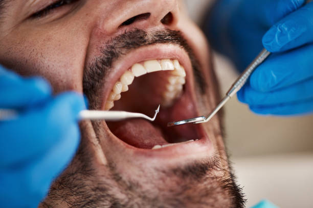 Best Knocked-Out Tooth Emergency  in Granite Falls, MN