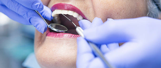 Best Chipped Tooth Repair Near Me  in Granite Falls, MN